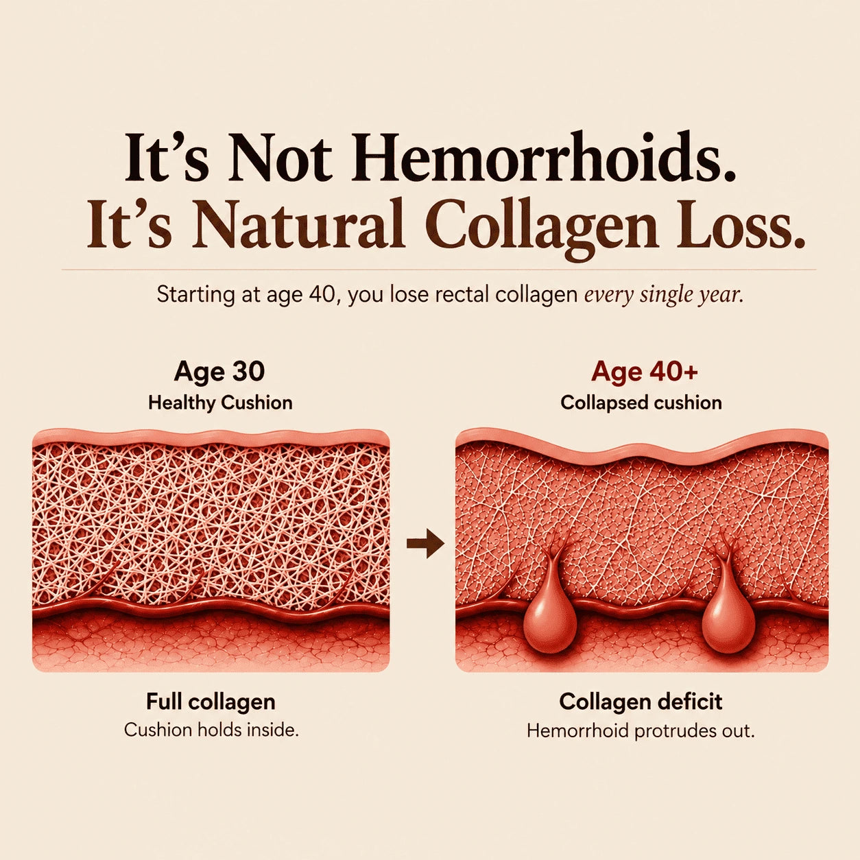 Natural collagen loss infographic